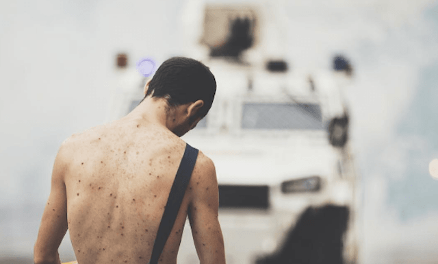 Will it ever get better in Venezuela? Venezuela Protest 2017